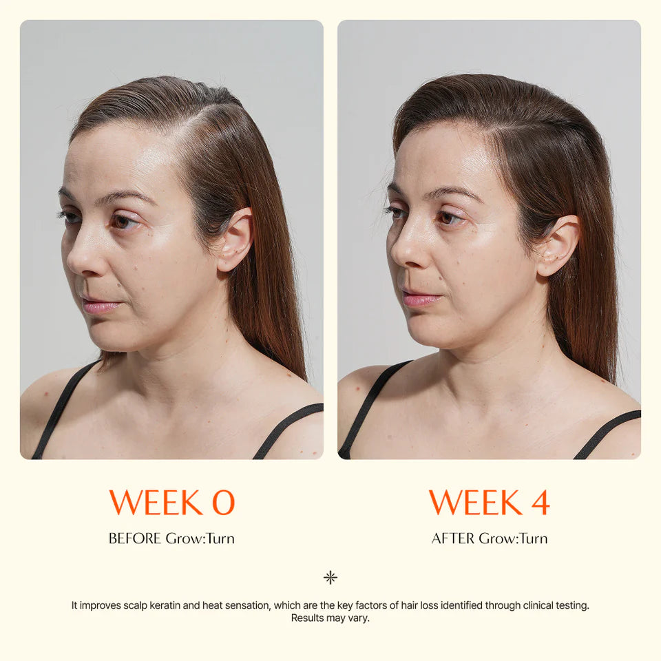 LilyRoot™ Scalp Revival Serum