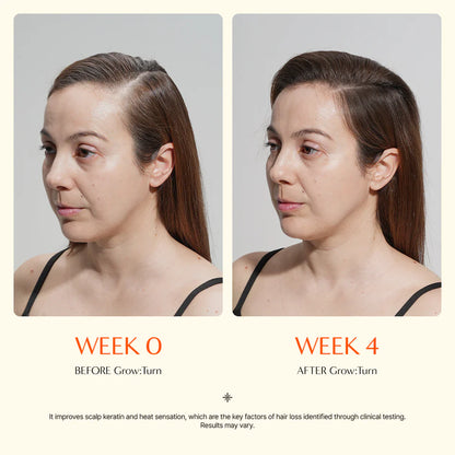 LilyRoot™ Scalp Revival Serum