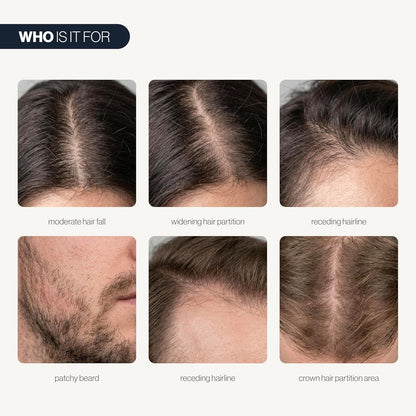 Rosemary Hair Growth Rollerball Serum
