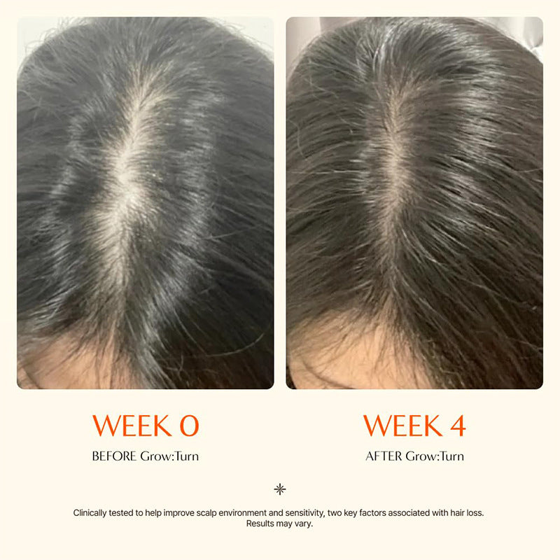 LilyRoot™ Scalp Revival Serum