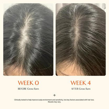 LilyRoot™ Scalp Revival Serum